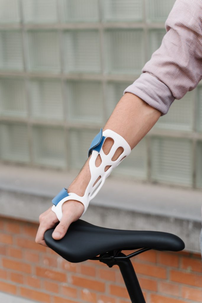 A client wears a highly durable 3D-printed arm brace